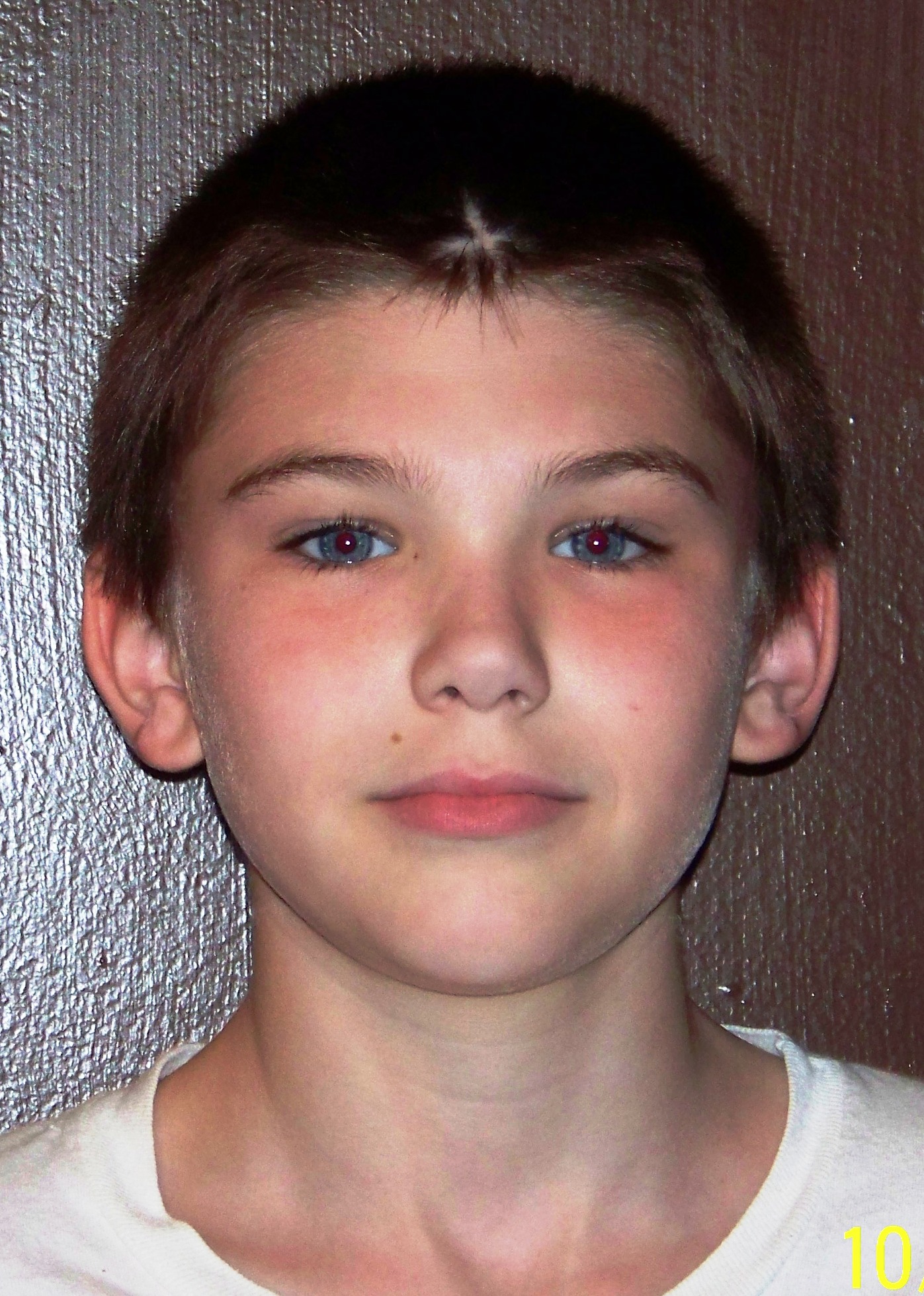 Jacob Matthew Baxter  Little